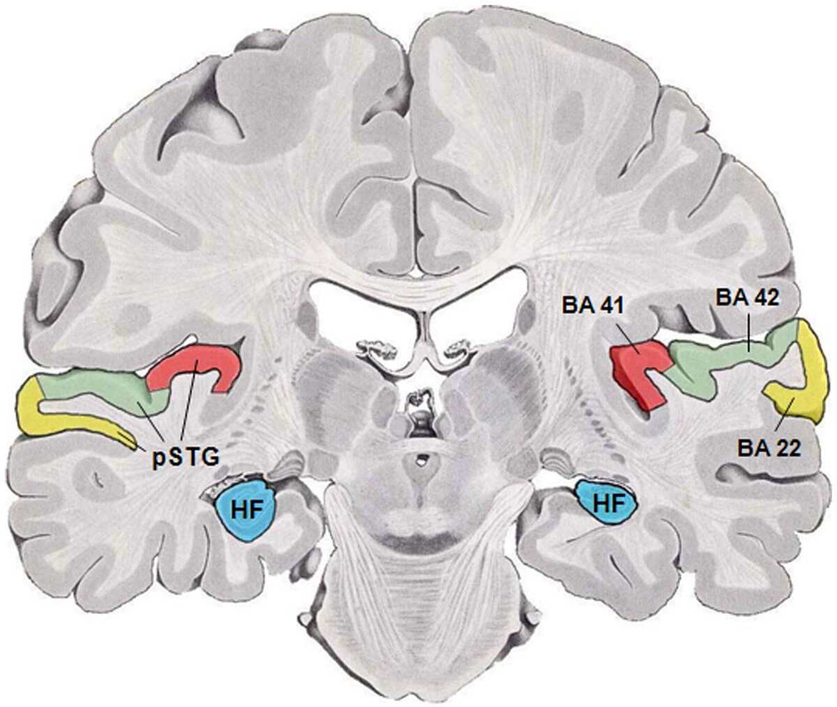 Title: Human temporal lobe areas | Author: Talbot K, Louneva N, Cohen JW, Kazi H, Blake DJ, et al. | Source: doi: 10.1371/journal.pone.0016886 | License: CC BY 2.5