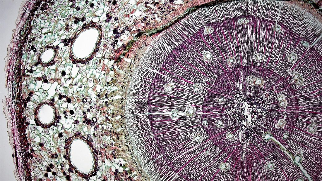 Title: Gymnosperm Stem: Periderm and Cortex in Three Year Pinus | Source: Berkshire Community College Bioscience Image Library | License: CC0
