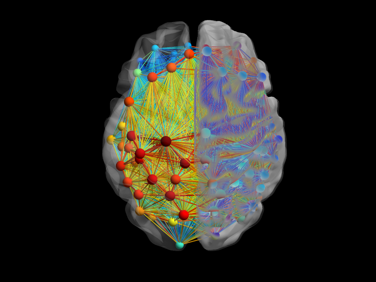 Title: Neurological connections | Credit: NIH Image Gallery | Source: Flickr | License: CC BY-NC 2.0